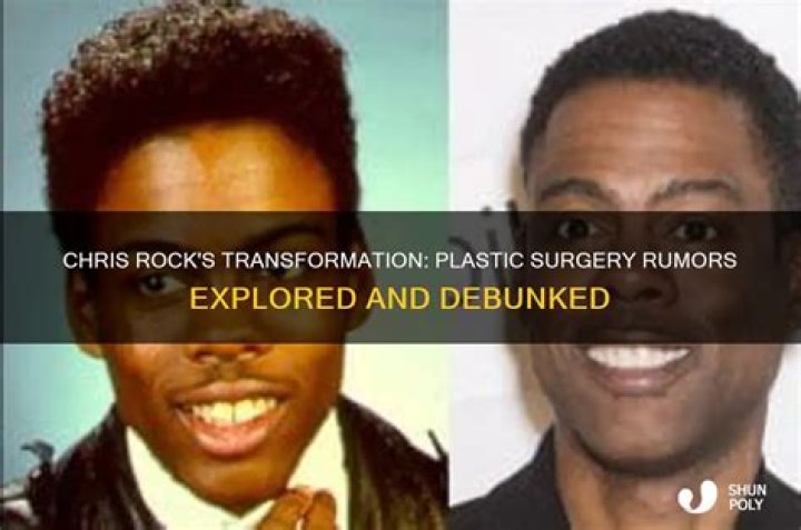 Chris Rock Plastic Surgery: What Are Some of The Potentialities?