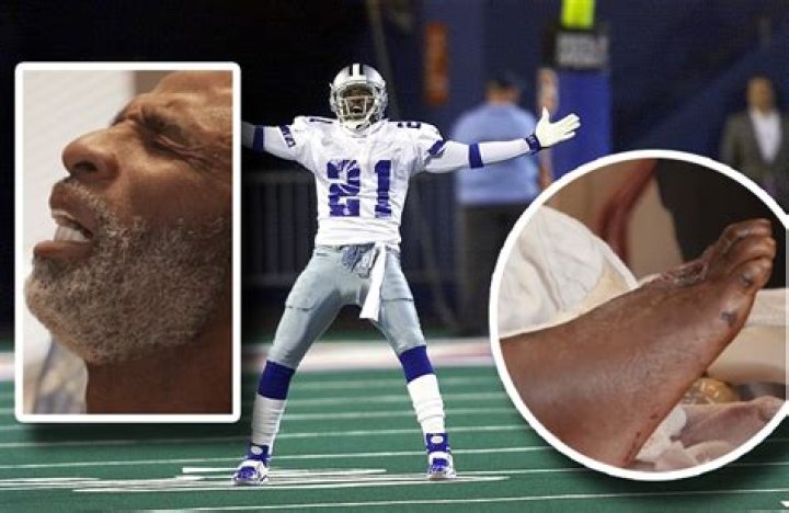 Deion Sanders foot amputation: What disease does Deion Sanders have?