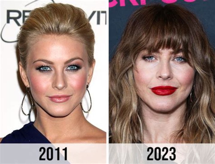 Julianne Hough Plastic Surgery: Exploring the Rumors and Realities Behind Her Timeless Beauty