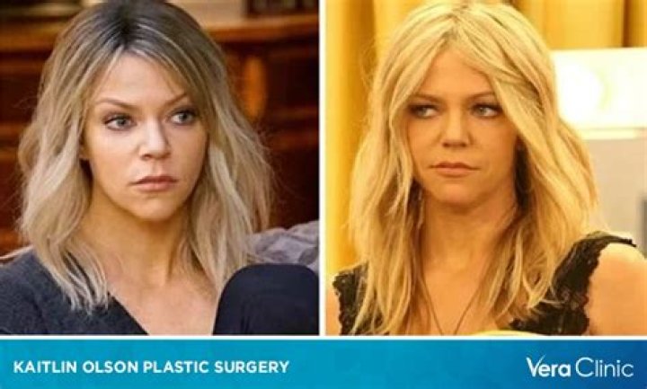 Kaitlin Olson Plastic Surgery: From Sunny Sets to Speculative Surgeries!