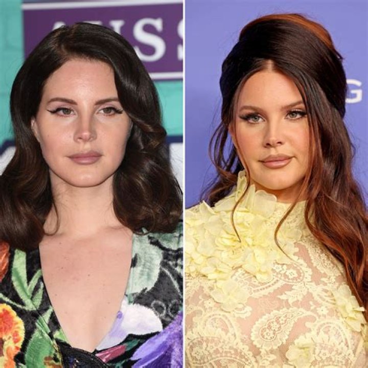 Lana Del Rey Before and After A Look at Those Subtle Changes!
