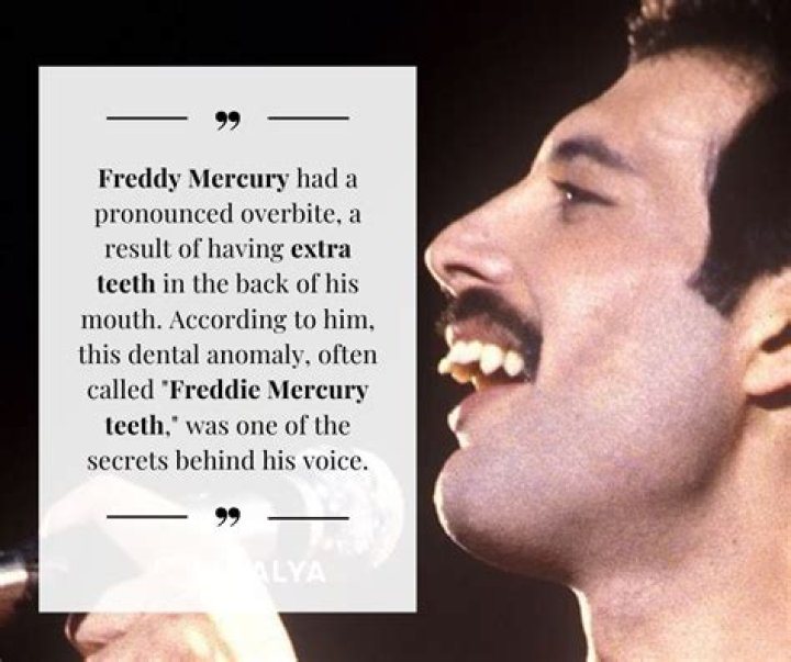 Who inherited Freddie Mercury’s money? How much was Freddie Mercury worth when he died?