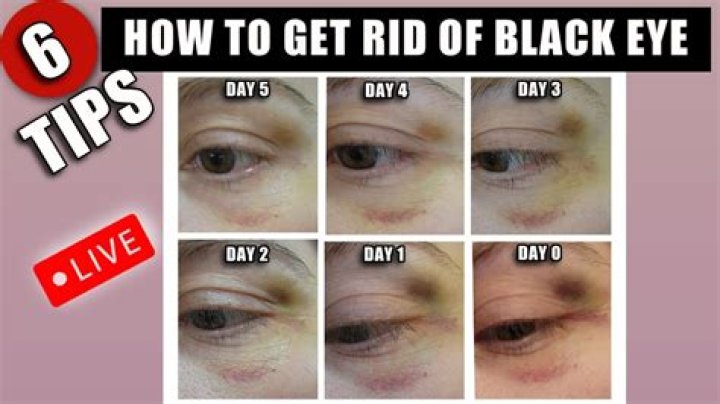 Why did Bruce’s eyes turn black? – Celebrity